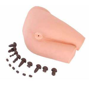 The role of the rectal examination operation model