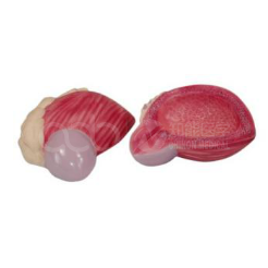 Enlarged bladder model